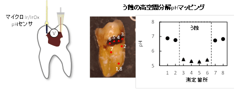 tooth ph